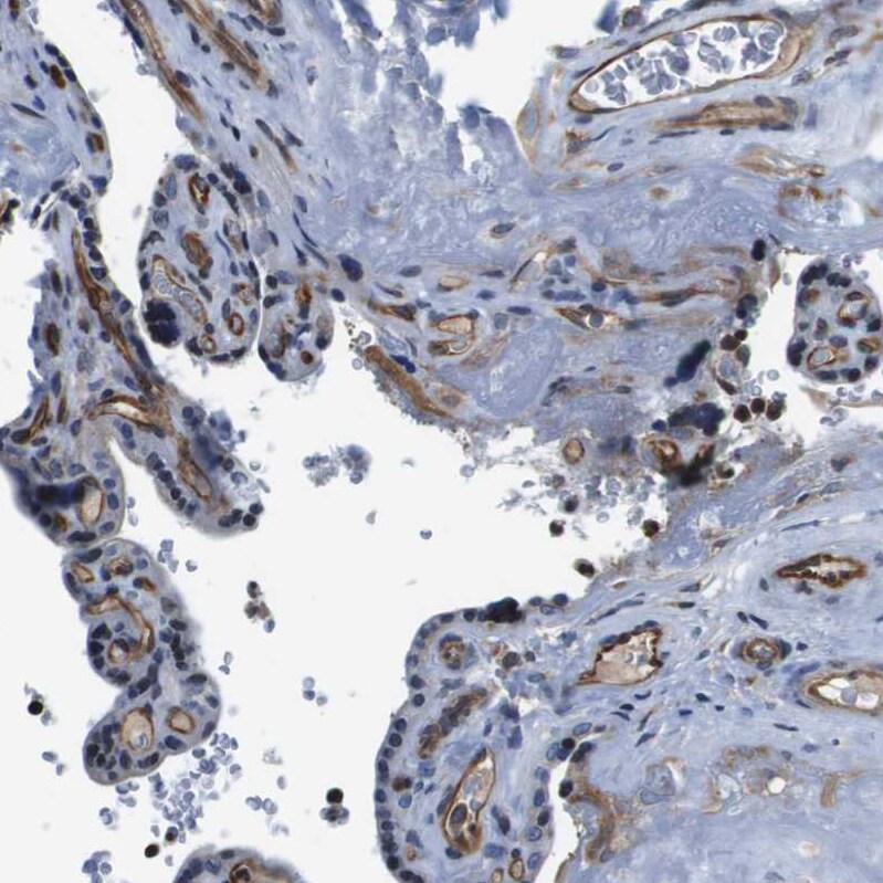 FAM62A Antibody - BSA Free Immunohistochemistry-Paraffin: FAM62A Antibody - BSA Free [NBP1-84741]