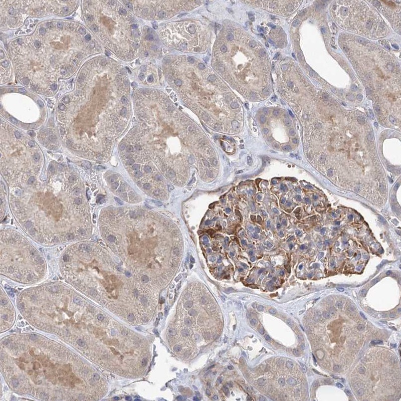 RWDD4A Antibody - BSA Free Immunohistochemistry-Paraffin: RWDD4A Antibody [NBP1-84743]
