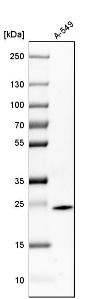 Glutathione S-Transferase pi 1/GSTP1 Antibody - BSA Free Western Blot: Glutathione S-Transferase pi 1/GSTP1 Antibody - BSA Free [NBP1-84748]