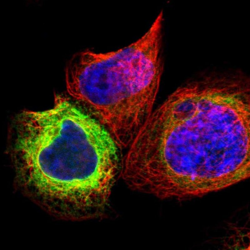 SCD-1 Antibody - BSA Free Immunocytochemistry/ Immunofluorescence: SCD-1 Antibody [NBP1-84749]