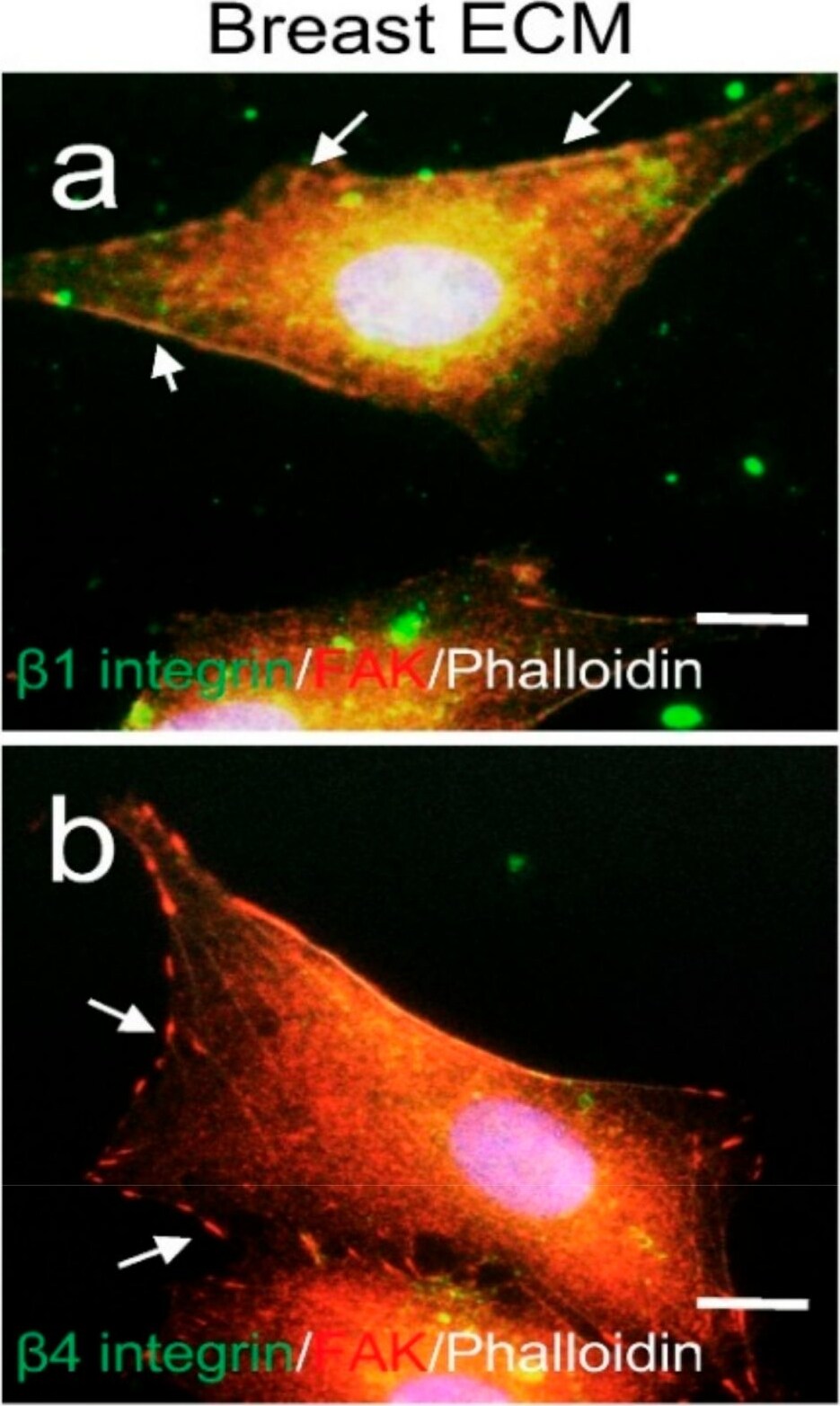 FAK Antibody