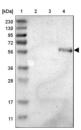 ZMPSTE24 Antibody - BSA Free Western Blot: ZMPSTE24 Antibody - BSA Free [NBP1-84755]