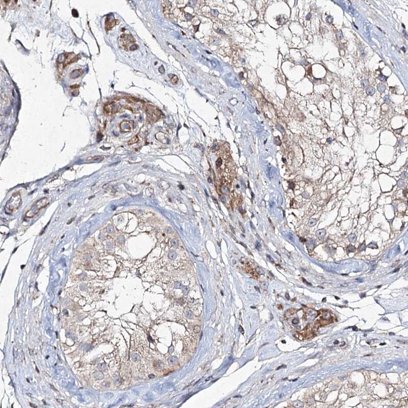 FANCL Antibody - BSA Free Immunohistochemistry-Paraffin: FANCL Antibody [NBP1-84758]