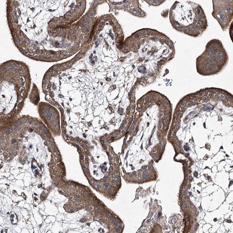 FANCL Antibody - BSA Free Immunohistochemistry-Paraffin: FANCL Antibody [NBP1-84758]