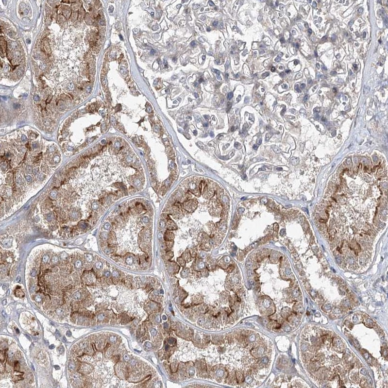 FANCL Antibody - BSA Free Immunohistochemistry-Paraffin: FANCL Antibody [NBP1-84758]