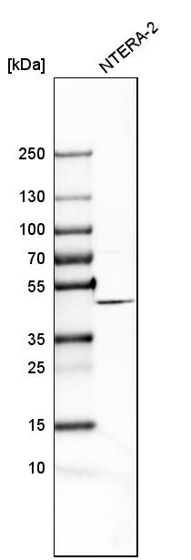 FANCL Antibody - BSA Free Western Blot: FANCL Antibody - BSA Free [NBP1-84758]