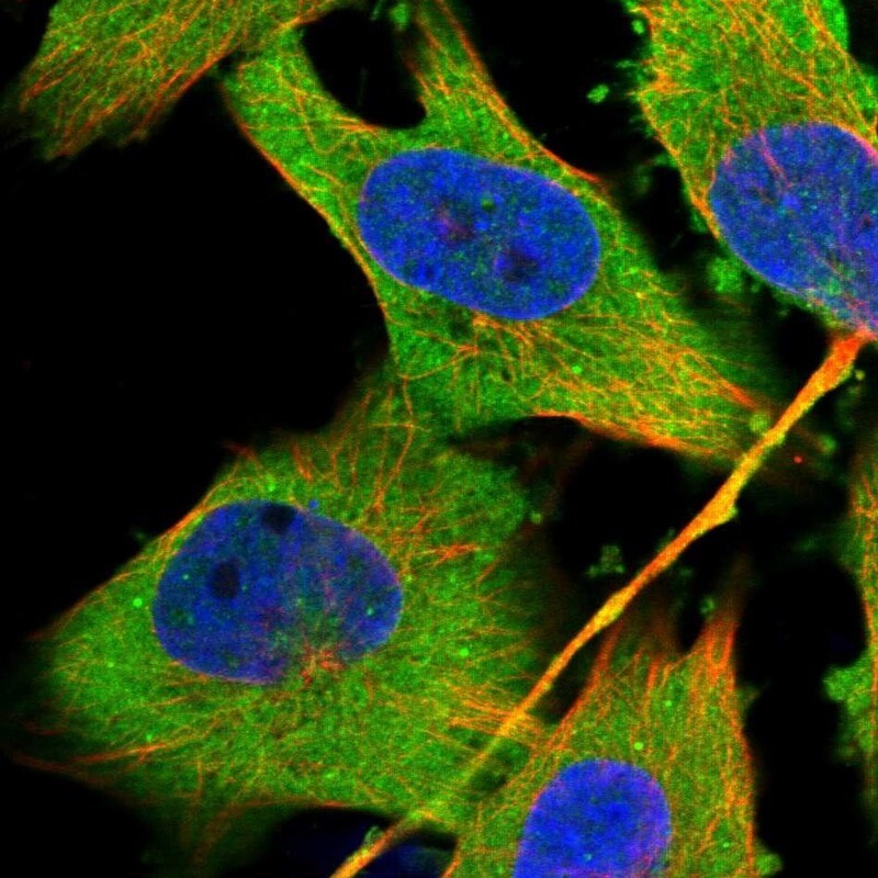 EXOC7 Antibody - BSA Free Immunocytochemistry/ Immunofluorescence: EXOC7 Antibody [NBP1-84767]