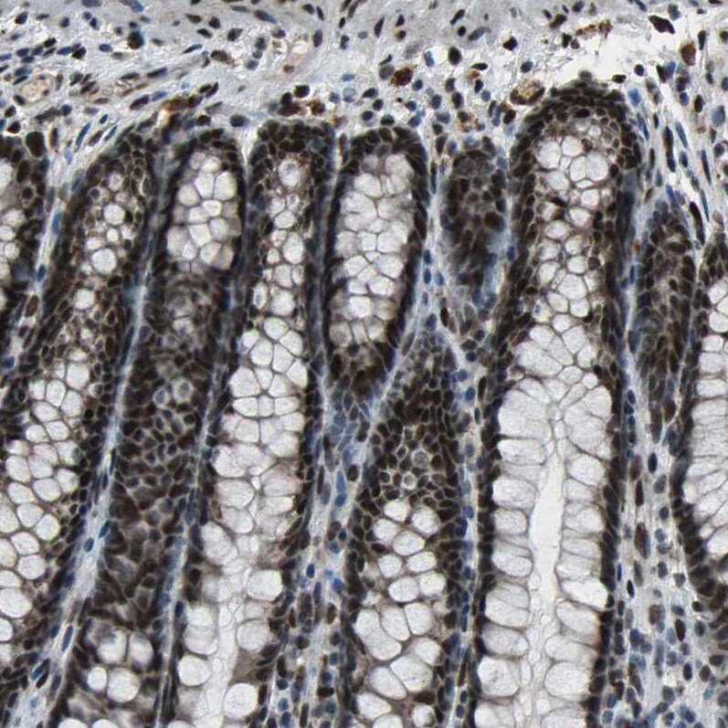 ELF2 Antibody - BSA Free Immunohistochemistry-Paraffin: ELF2 Antibody - BSA Free [NBP1-84770]
