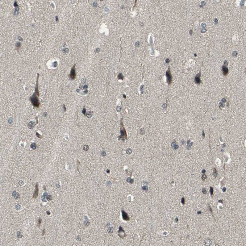 ELF2 Antibody - BSA Free Immunohistochemistry-Paraffin: ELF2 Antibody - BSA Free [NBP1-84770]