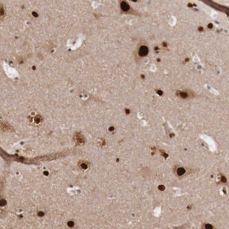 KHDRBS3 Antibody - BSA Free Immunohistochemistry-Paraffin: KHDRBS3 Antibody [NBP1-84774]