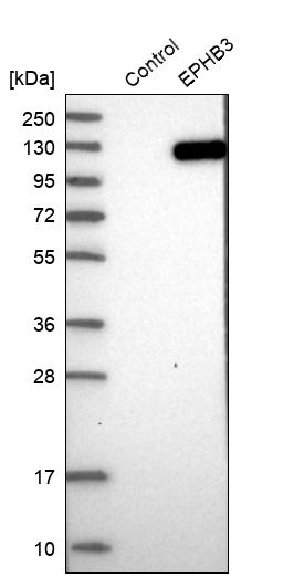 EphB3 Antibody - BSA Free Western Blot: EphB3 Antibody - BSA Free [NBP1-84776]