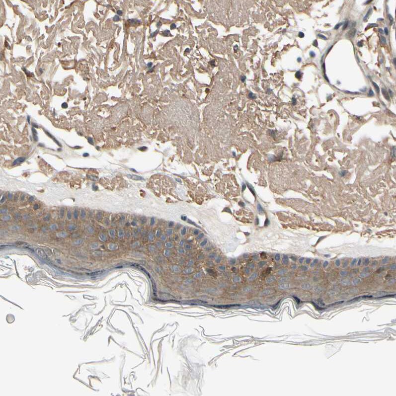 EphB3 Antibody - BSA Free Immunohistochemistry-Paraffin: EphB3 Antibody - BSA Free [NBP1-84776]