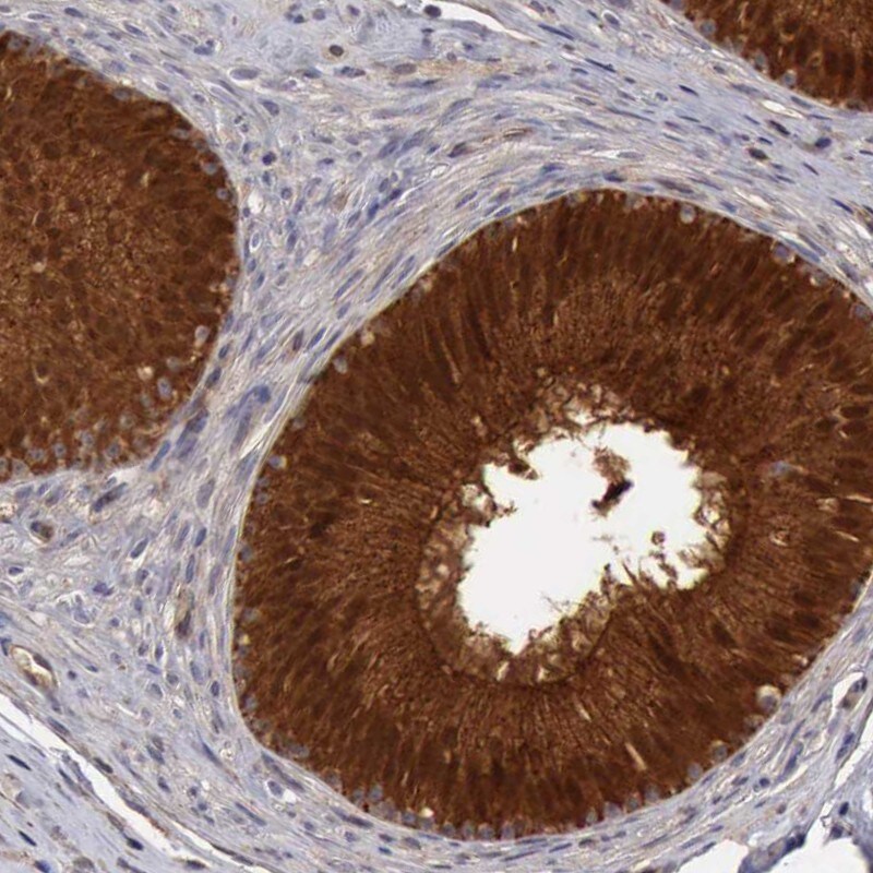 BMX Antibody - BSA Free Immunohistochemistry-Paraffin: BMX Antibody - BSA Free [NBP1-84778]