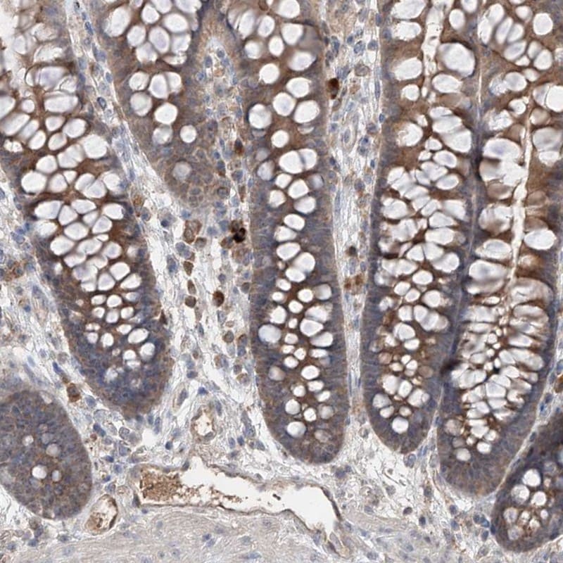 Endothelin-1 Antibody - BSA Free Immunohistochemistry-Paraffin: Endothelin-1 Antibody [NBP1-84779]