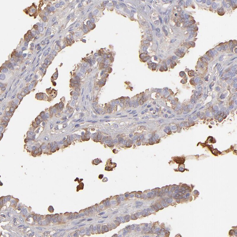 MRP4/ABCC4 Antibody - BSA Free Immunohistochemistry-Paraffin: MRP4/ABCC4 Antibody [NBP1-84782]