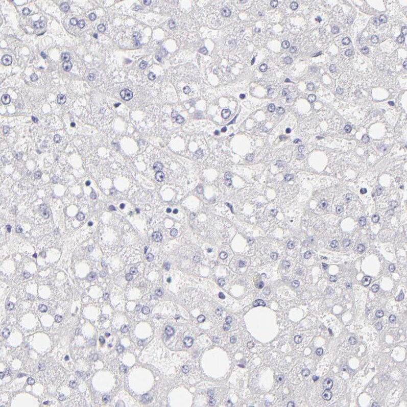 MRP4/ABCC4 Antibody - BSA Free Immunohistochemistry-Paraffin: MRP4/ABCC4 Antibody [NBP1-84782]