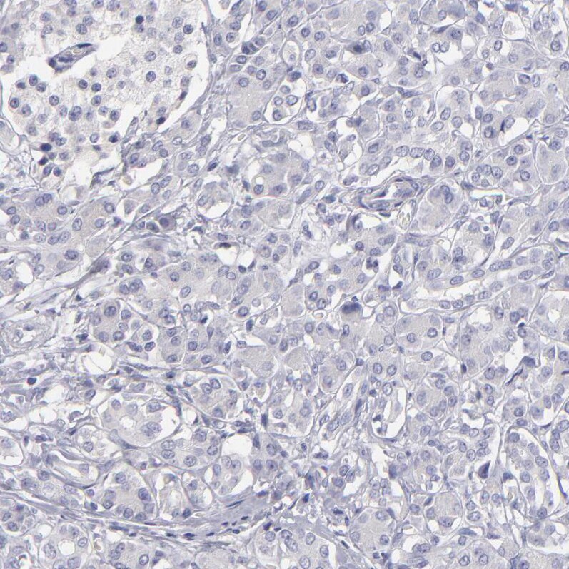 MRP4/ABCC4 Antibody - BSA Free Immunohistochemistry-Paraffin: MRP4/ABCC4 Antibody [NBP1-84782]