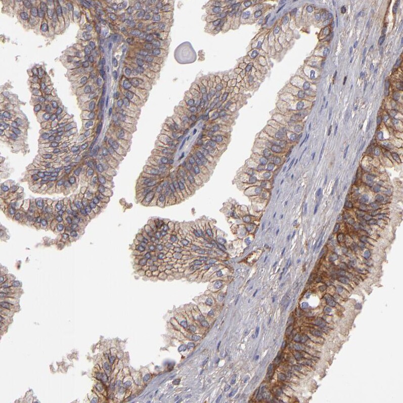 MRP4/ABCC4 Antibody - BSA Free Immunohistochemistry-Paraffin: MRP4/ABCC4 Antibody [NBP1-84782]