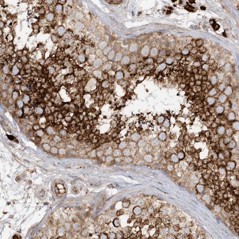 HIPPI Antibody - BSA Free Immunohistochemistry-Paraffin: HIPPI Antibody - BSA Free [NBP1-84787]