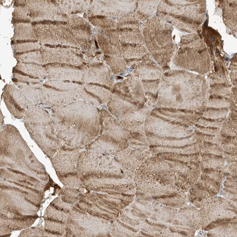 HIPPI Antibody - BSA Free Immunohistochemistry-Paraffin: HIPPI Antibody - BSA Free [NBP1-84787]