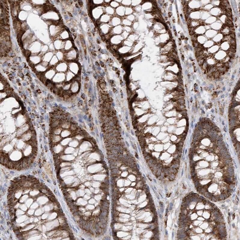 HIPPI Antibody - BSA Free Immunohistochemistry-Paraffin: HIPPI Antibody - BSA Free [NBP1-84787]
