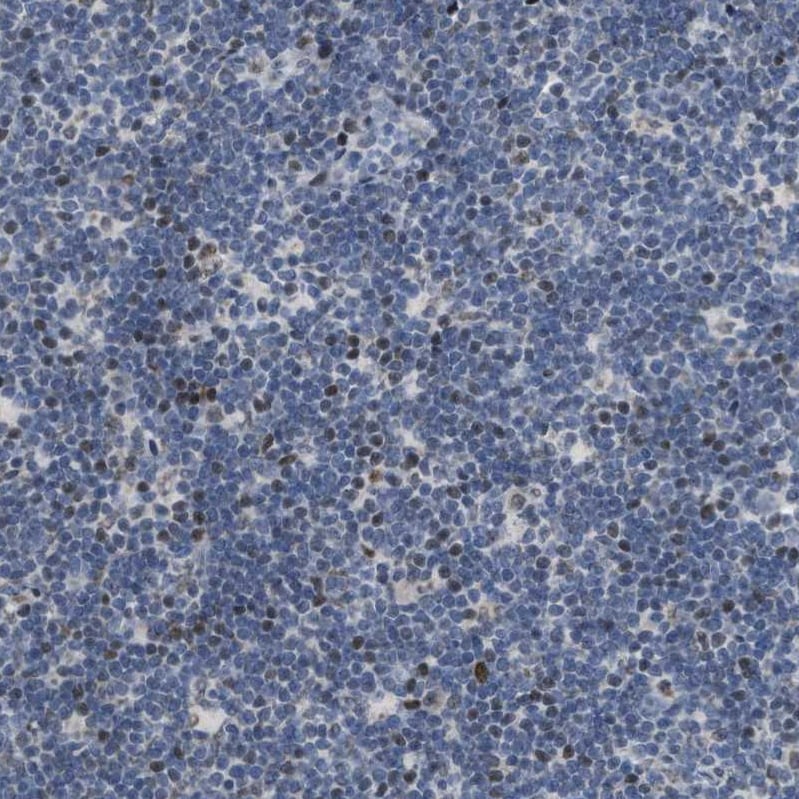 SETDB1 Antibody - BSA Free Immunohistochemistry-Paraffin: SETDB1 Antibody - BSA Free [NBP1-84790]