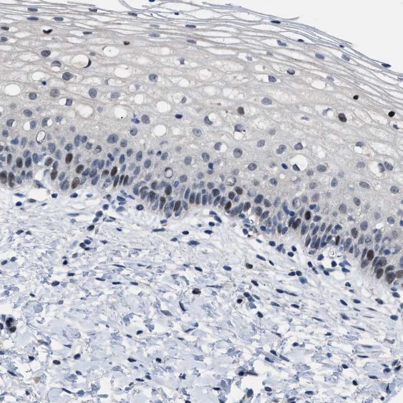 SETDB1 Antibody - BSA Free Immunohistochemistry-Paraffin: SETDB1 Antibody - BSA Free [NBP1-84790]