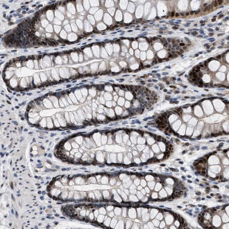 SETDB1 Antibody - BSA Free Immunohistochemistry-Paraffin: SETDB1 Antibody - BSA Free [NBP1-84790]
