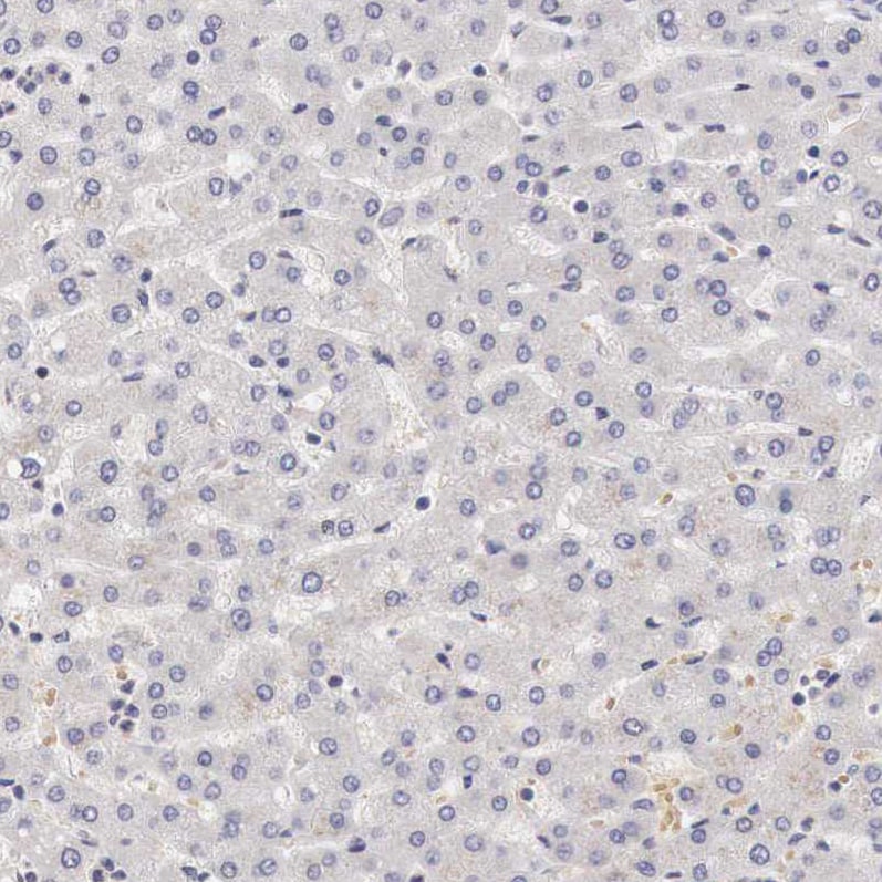 GATA-1 Antibody - BSA Free Immunohistochemistry-Paraffin: GATA-1 Antibody - BSA Free [NBP1-84793]