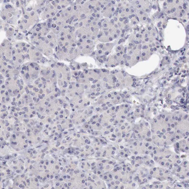 GATA-1 Antibody - BSA Free Immunohistochemistry-Paraffin: GATA-1 Antibody - BSA Free [NBP1-84793]