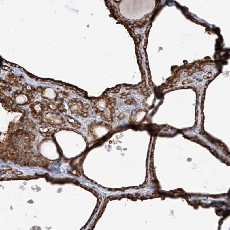 PDIA6 Antibody - BSA Free Immunohistochemistry-Paraffin: PDIA6 Antibody - BSA Free [NBP1-84798]