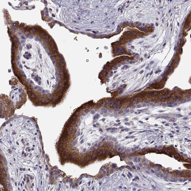 ERO1L Antibody - BSA Free Immunohistochemistry-Paraffin: ERO1L Antibody - BSA Free [NBP1-84799]