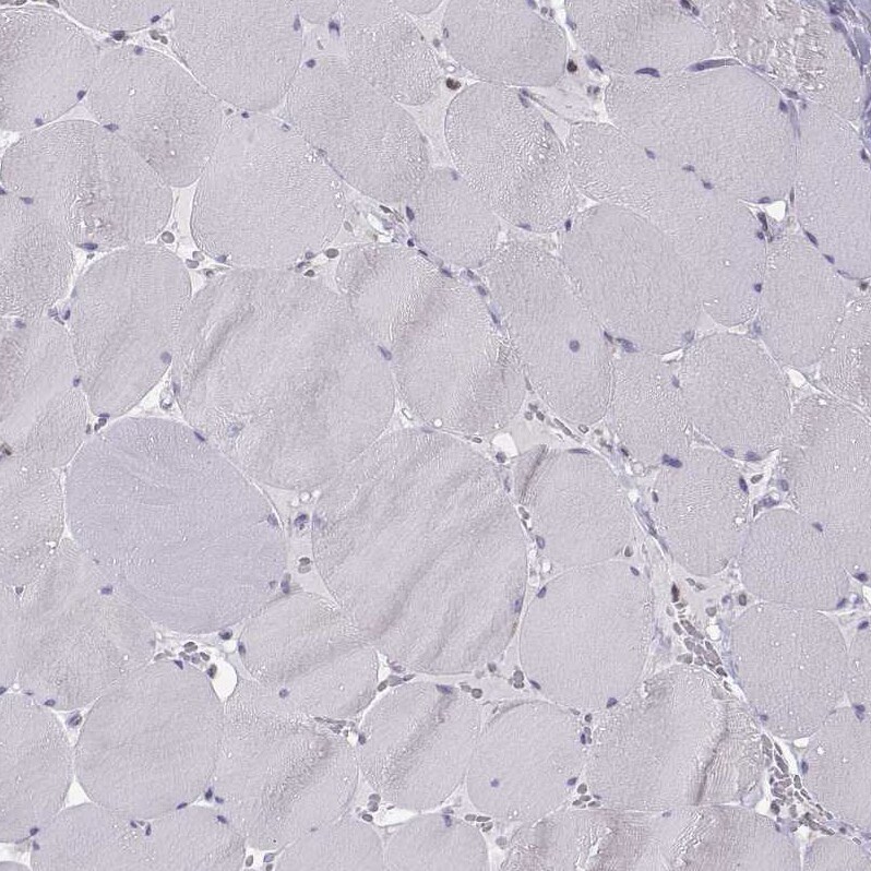 ERO1L Antibody - BSA Free Immunohistochemistry-Paraffin: ERO1L Antibody - BSA Free [NBP1-84799]