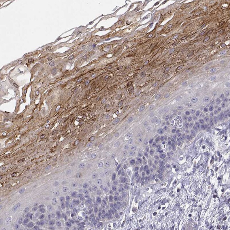 ERO1L Antibody - BSA Free Immunohistochemistry-Paraffin: ERO1L Antibody - BSA Free [NBP1-84799]