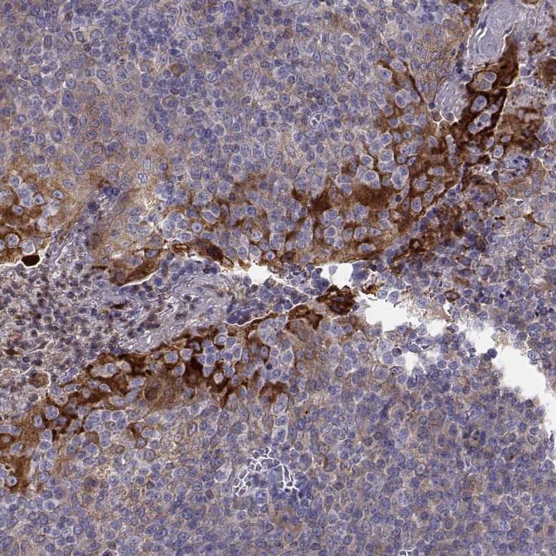 ERO1L Antibody - BSA Free Immunohistochemistry-Paraffin: ERO1L Antibody - BSA Free [NBP1-84799]