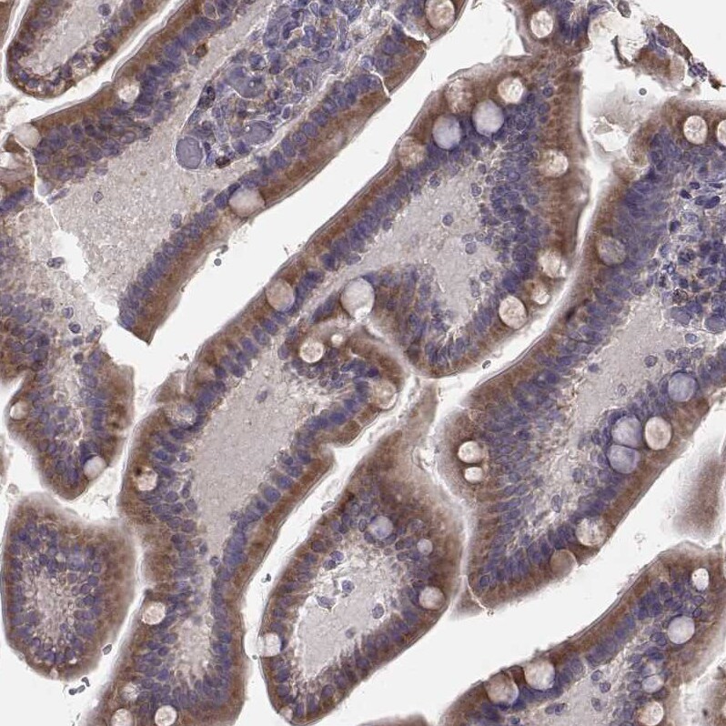 ERO1L Antibody - BSA Free Immunohistochemistry-Paraffin: ERO1L Antibody - BSA Free [NBP1-84799]