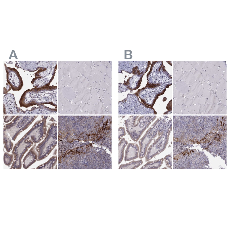 ERO1L Antibody - BSA Free Immunohistochemistry-Paraffin: ERO1L Antibody - BSA Free [NBP1-84799]