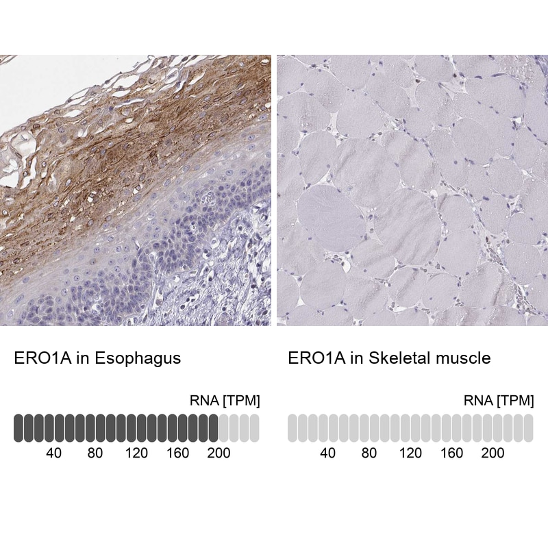 ERO1L Antibody - BSA Free Immunohistochemistry-Paraffin: ERO1L Antibody - BSA Free [NBP1-84799]