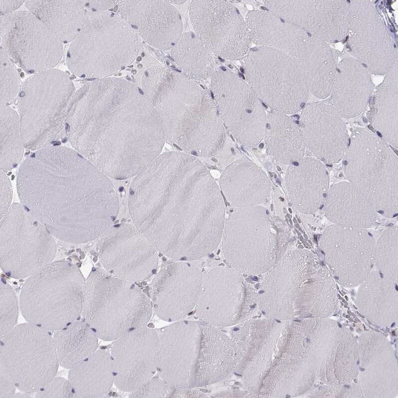 ERO1L Antibody - BSA Free Immunohistochemistry-Paraffin: ERO1L Antibody - BSA Free [NBP1-84800]