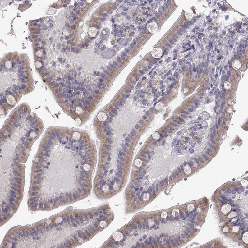 ERO1L Antibody - BSA Free Immunohistochemistry-Paraffin: ERO1L Antibody - BSA Free [NBP1-84800]
