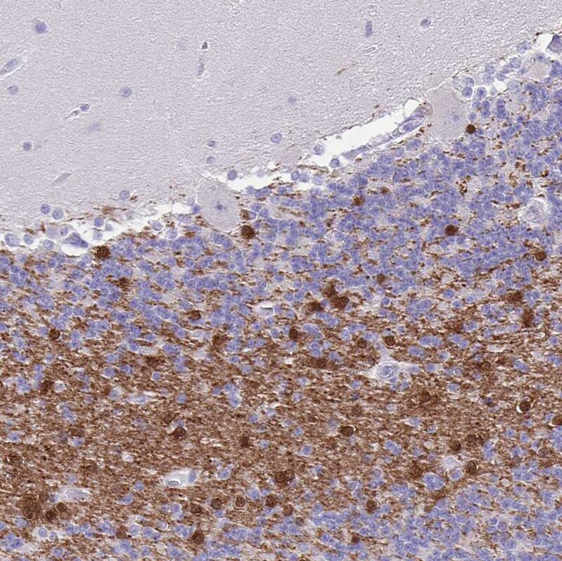 ERMN Antibody - BSA Free Immunohistochemistry-Paraffin: ERMN Antibody [NBP1-84801]