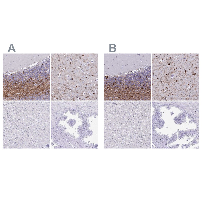 ERMN Antibody - BSA Free Immunohistochemistry-Paraffin: ERMN Antibody [NBP1-84801]