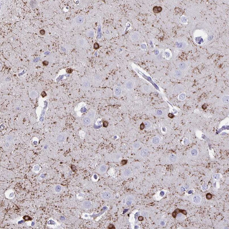 ERMN Antibody - BSA Free Immunohistochemistry-Paraffin: ERMN Antibody [NBP1-84801]