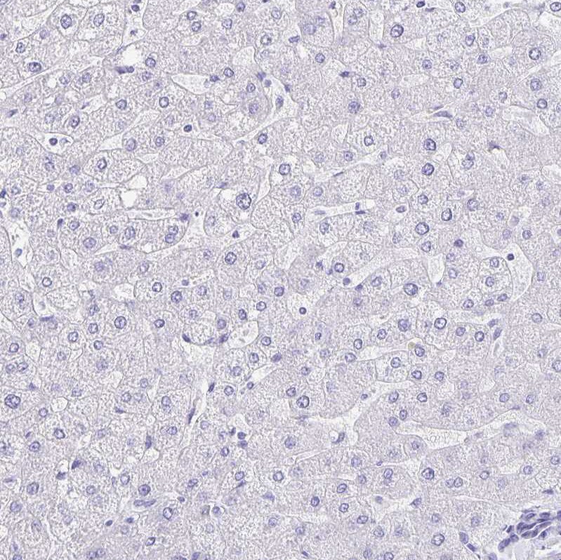 ERMN Antibody - BSA Free Immunohistochemistry-Paraffin: ERMN Antibody [NBP1-84801]