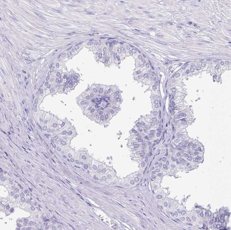 ERMN Antibody - BSA Free Immunohistochemistry-Paraffin: ERMN Antibody [NBP1-84801]