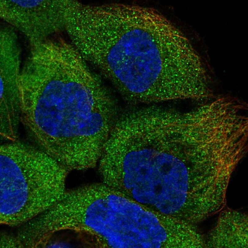 ERK3/MAPK6 Antibody - BSA Free Immunocytochemistry/ Immunofluorescence: ERK3/MAPK6 Antibody [NBP1-84806]
