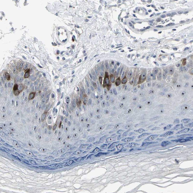 TACC3 Antibody - BSA Free Immunohistochemistry-Paraffin: TACC3 Antibody [NBP1-84811]
