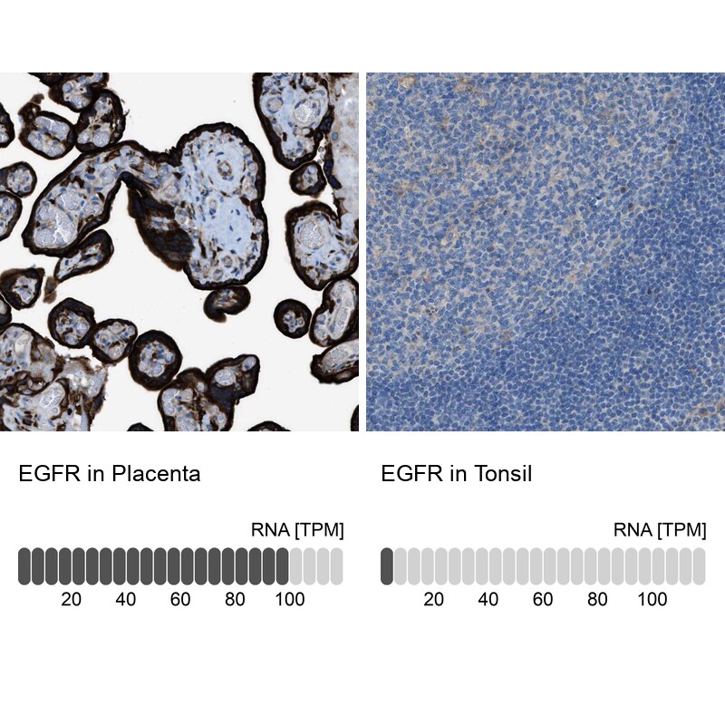 EGFR Antibody - BSA Free Immunohistochemistry-Paraffin: EGFR Antibody - BSA Free [NBP1-84814]