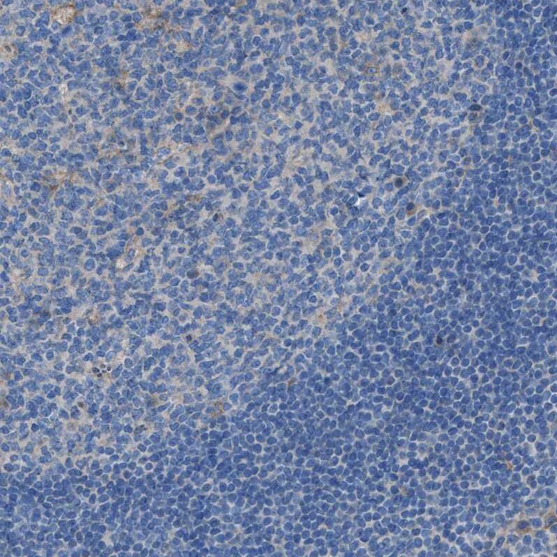 EGFR Antibody - BSA Free Immunohistochemistry-Paraffin: EGFR Antibody - BSA Free [NBP1-84814]