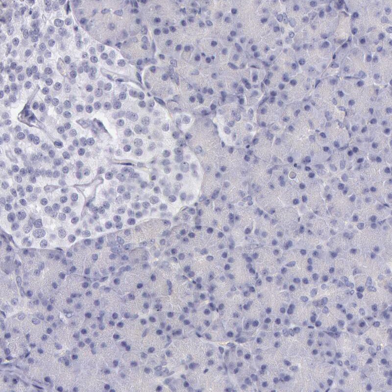 EGFR Antibody - BSA Free Immunohistochemistry-Paraffin: EGFR Antibody - BSA Free [NBP1-84815]